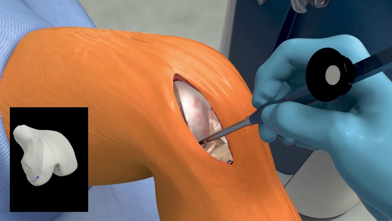Stryker Mako by Stryker - medical robot